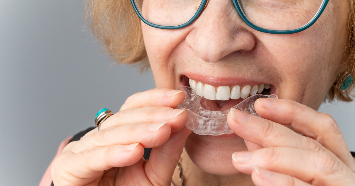 Ortodoncia En Adultos: Transformando Sonrisas En La Edad Adulta ...